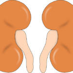 kidney failure