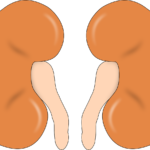 diabetes insipidus